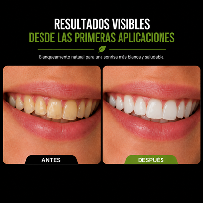 Blanqueador Dental Carbón Activado Sabor Coco